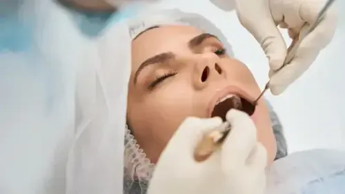 What is the Cost of a Dental Cap?